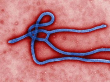 Вирус Эбола, вызвавший эпидемию в странах Западной Африки (фото CDC).